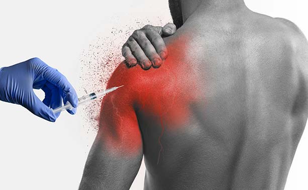 Mesotherapy
